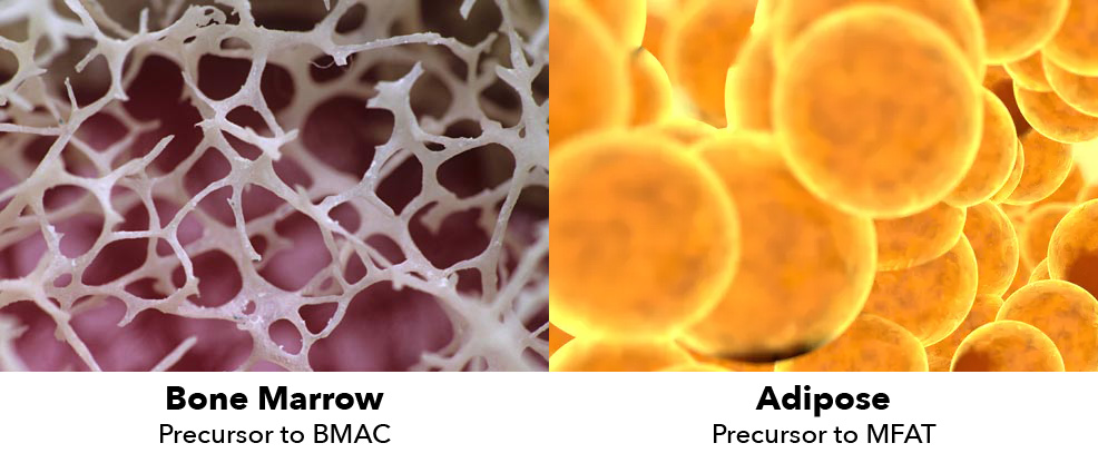 Image of bone marrow on left and adipose cells on right.
