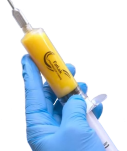 Adipose in a FatLok syringe shown in a page comparing microfat to PRP and BMAC.